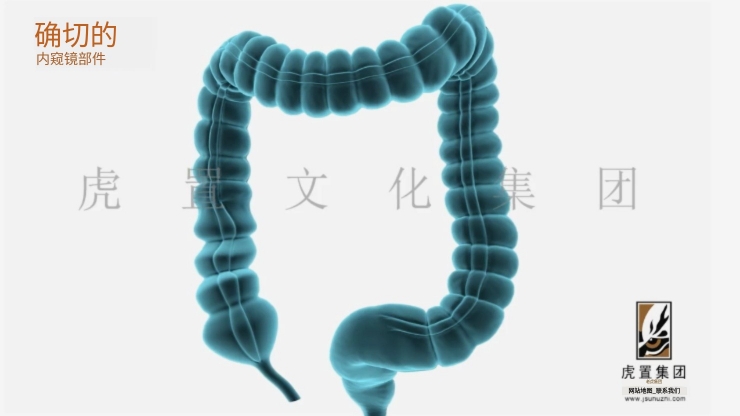 3d医学动画有哪些分类-虎置文化集团